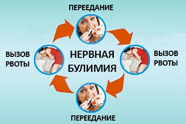 Лечение булимии в Тырныаузе